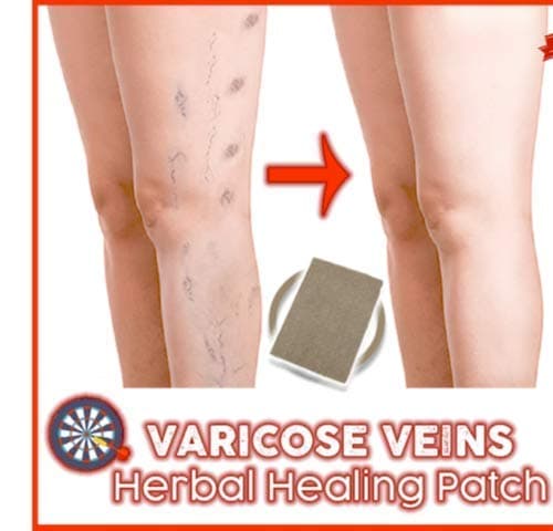 Varicose Veins Herbal Healing Patch 6PCS/Set