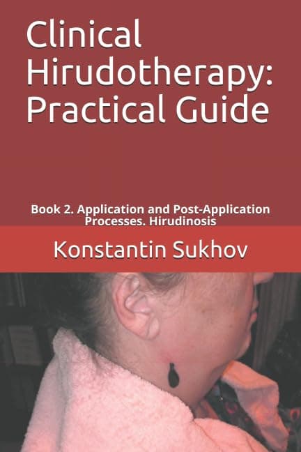 Clinical Hirudotherapy: Practical Guide: Book 2. Application and Post-Application Processes. Hirudinosis