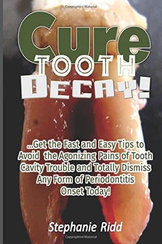 Cure Tooth Decay!: Get the Fast and Easy Tips to Avoid the Agonizing Pains of Tooth Cavity Trouble and Totally Dismiss Any Form of Periodontitis Onset Today! by Stephanie Ridd (2016-07-01)