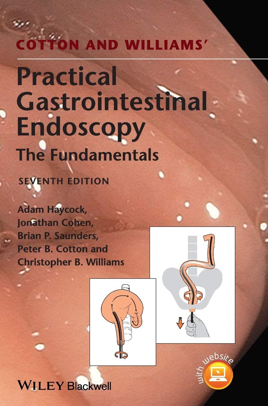 Cotton and Williams′ Practical Gastrointestinal Endoscopy: The Fundamentals