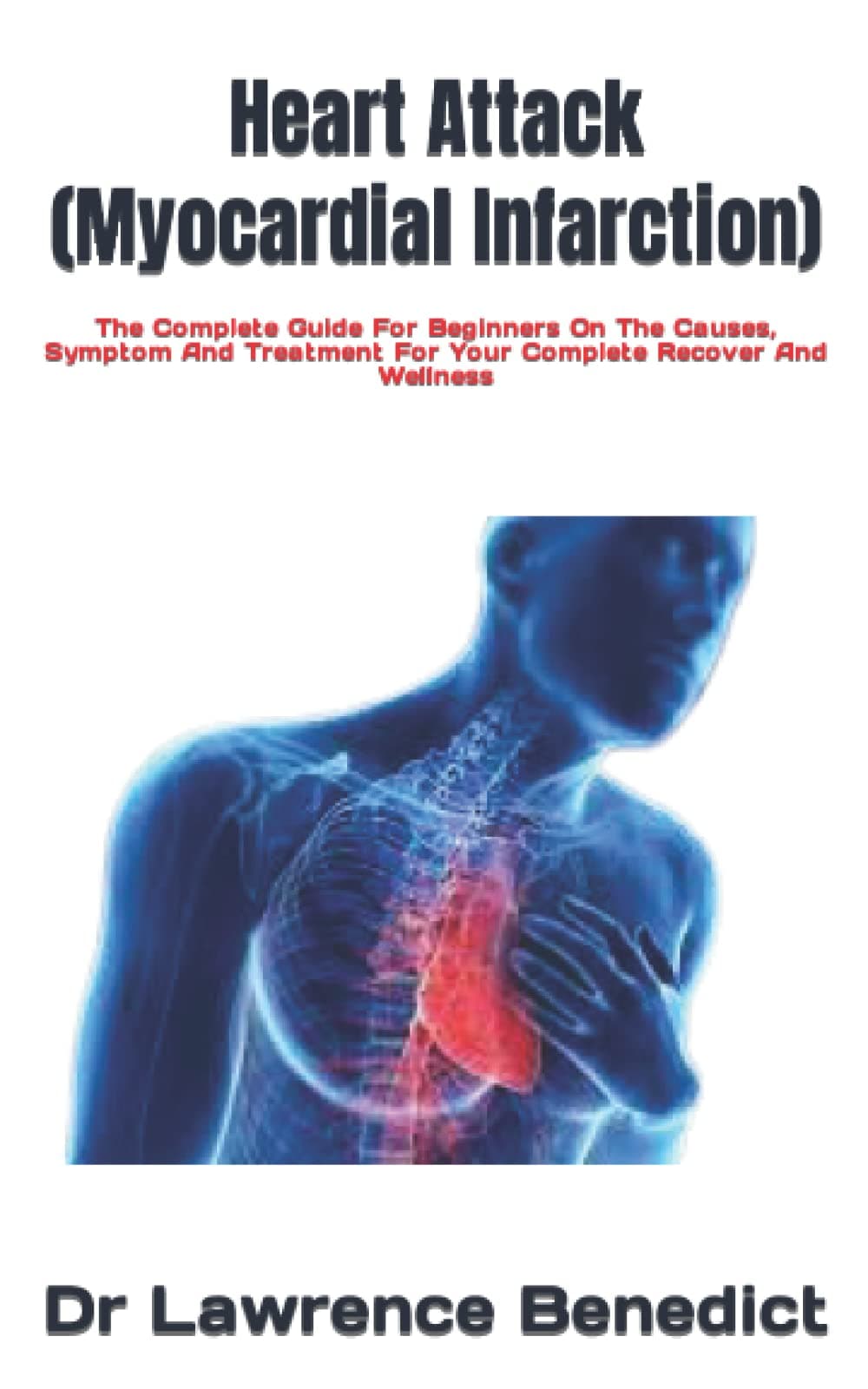 Heart Attack (Myocardial Infarction): The Complete Guide For Beginners On The Causes, Symptom And Treatment For Your Complete Recover And Wellness