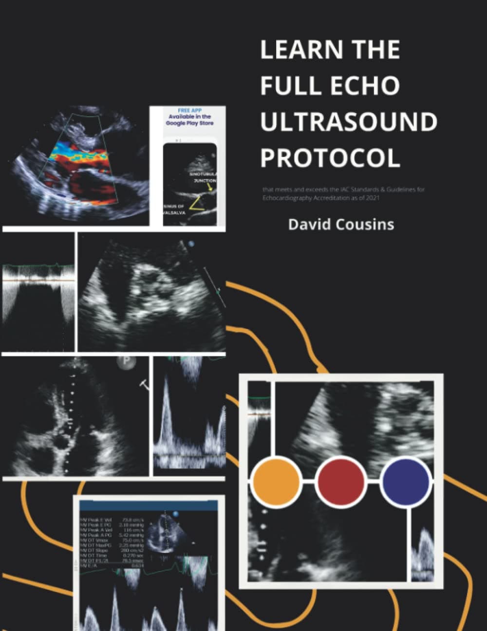 LEARN THE FULL ECHO TTE ECHOCARDIOGRAM ULTRASOUND PROTOCOL: that meets and exceeds the newly released IAC Standards and Guidelines for Adult ... Accreditation effective as of November 2021