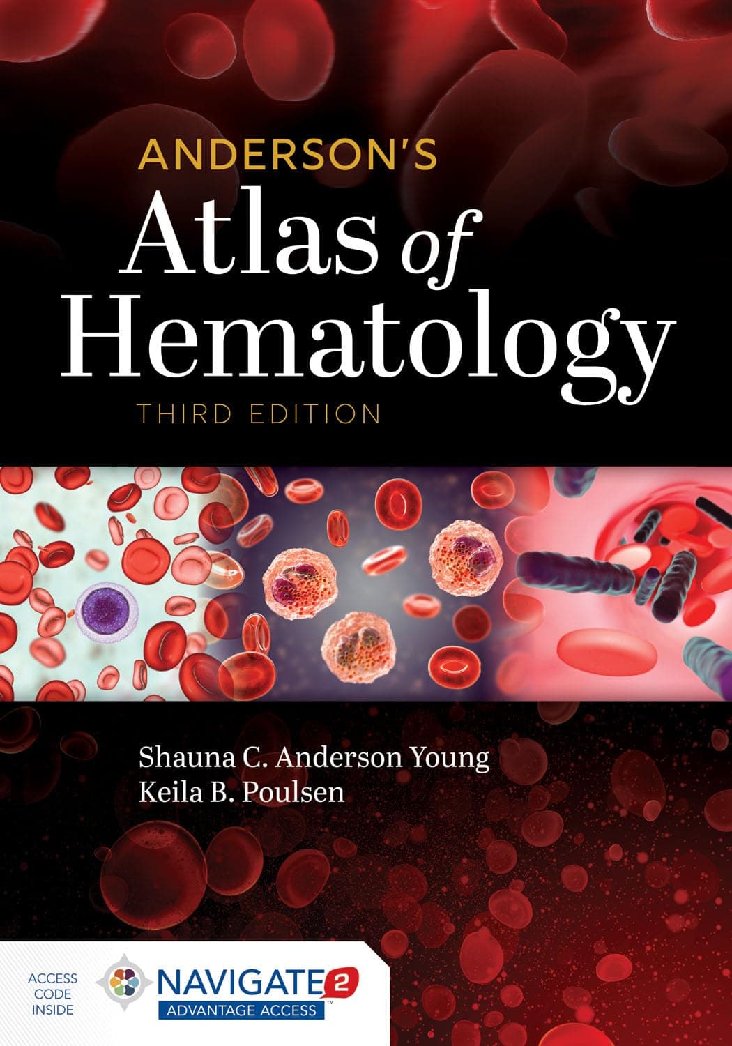 Anderson's Atlas of Hematology: .